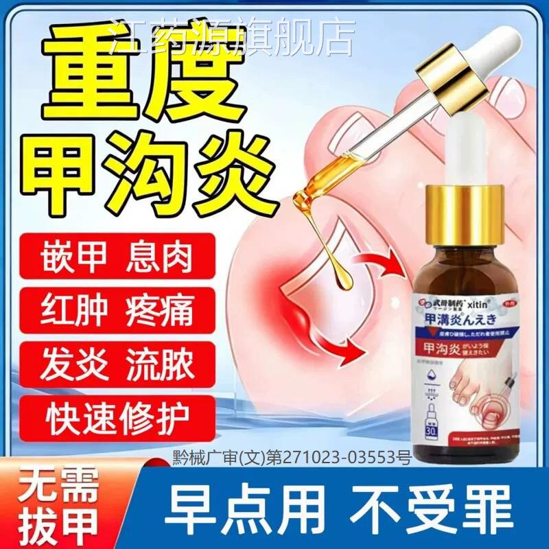 甲沟炎疗愈甲沟炎息肉去除药膏脚趾甲增黄厚变甲沟炎ZY江药源旗舰