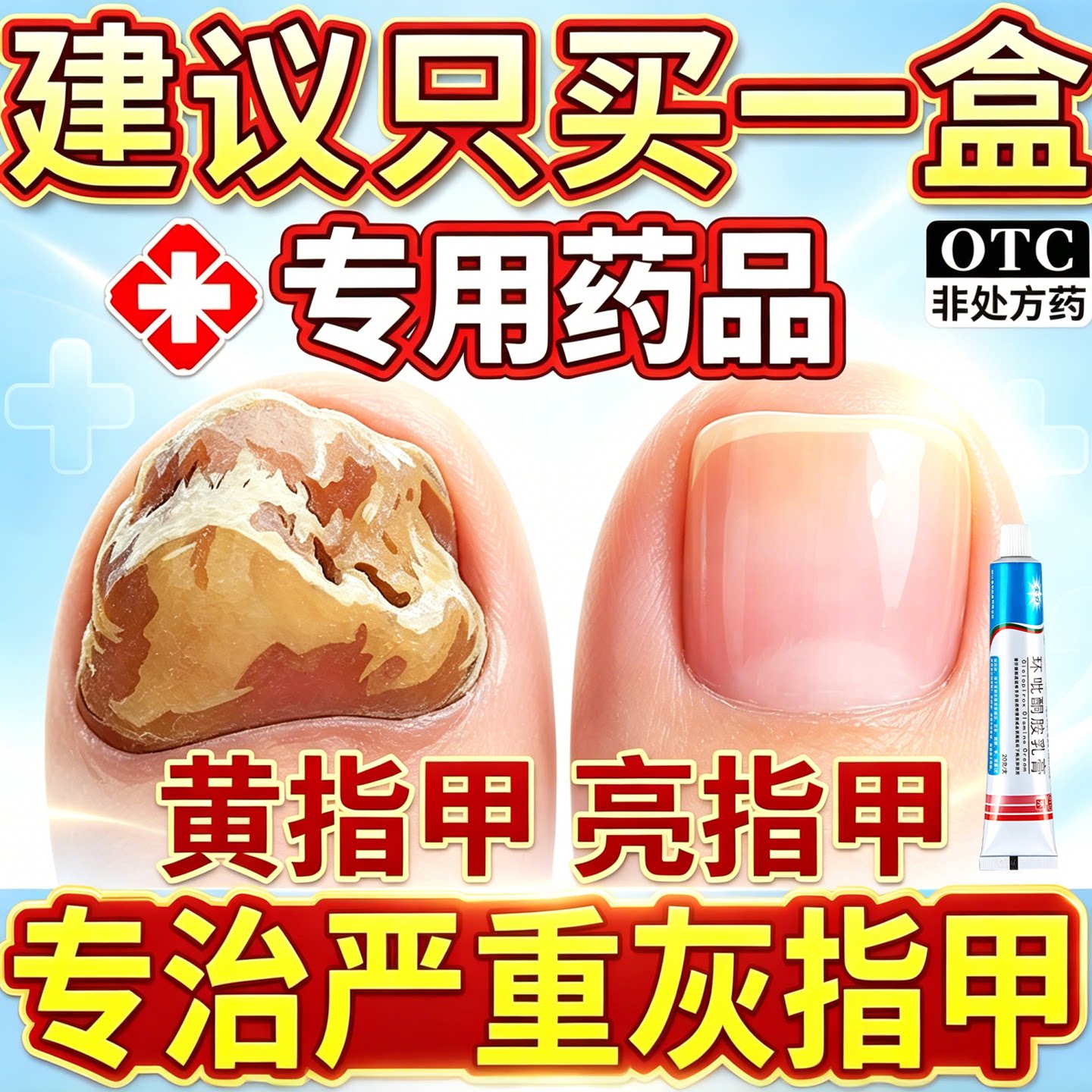 [金归]环吡酮胺乳膏1%*20g*1支/盒