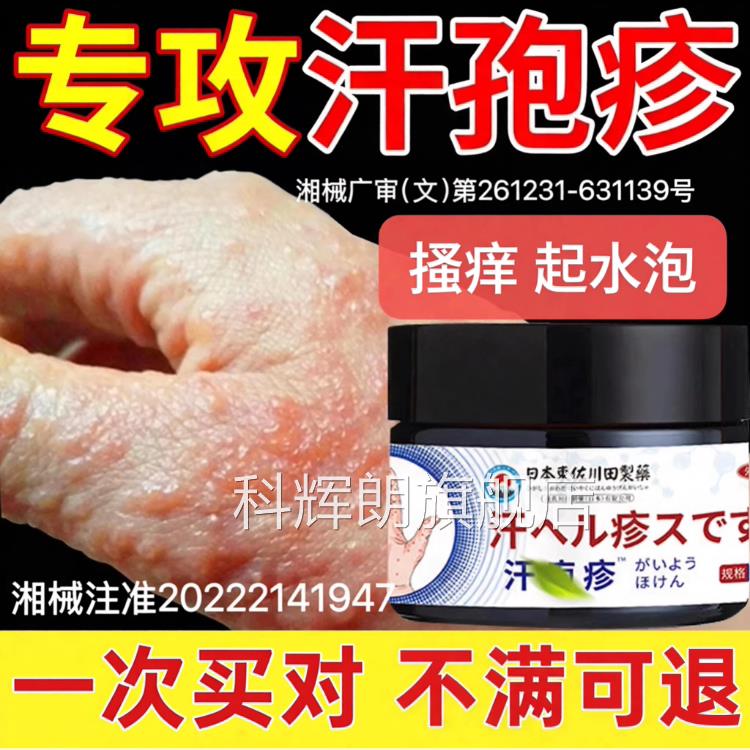 日本汗疱疹止痒膏手上起小泡孢疹汗状湿疹软膏真菌水感染脱皮专用