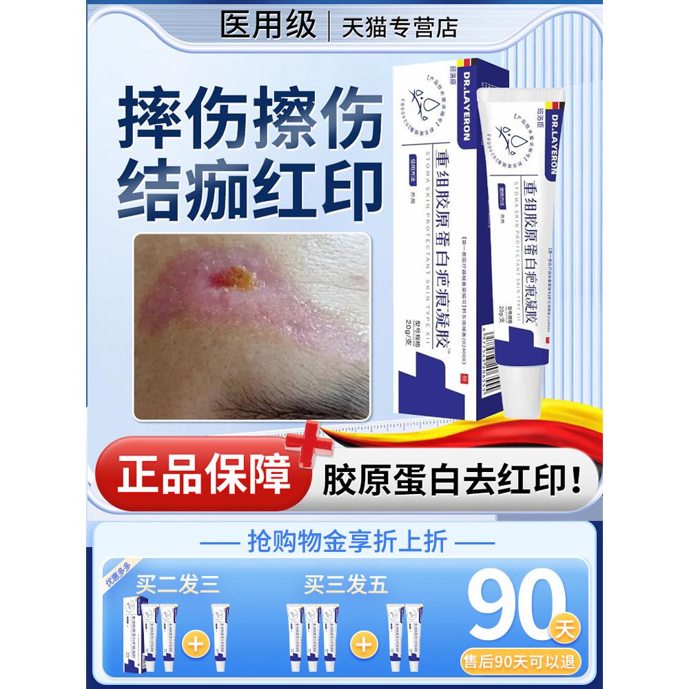 结痂后去红印黑印儿童摔伤擦伤疤掉痂后除痕修复点痣后退红淡印u9