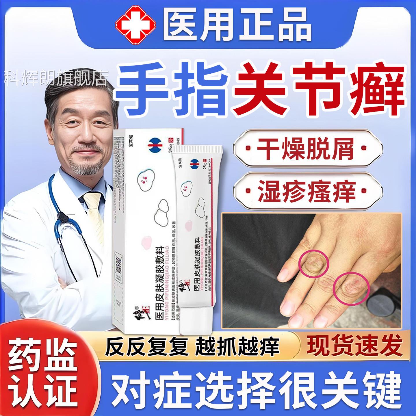 手指节癣手癣专膏用真菌关感染湿疹脱皮干裂增厚脱屑药足癣鹅掌风