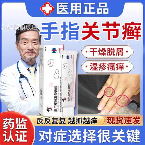 手指节癣手癣专膏用真菌关感染湿疹脱皮干裂增厚脱屑药足癣鹅掌风