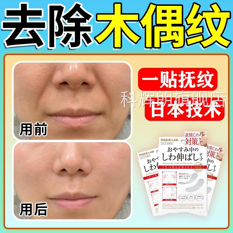木偶纹贴日去除法令纹消除神器本提拉淡化抚皱侧睡觉专用防表情贴