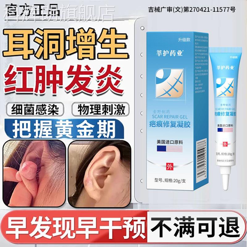 耳洞凸增生疤痕疙瘩起硬肉软化针可搭膏药贴止软化痒乳膏去BD科辉