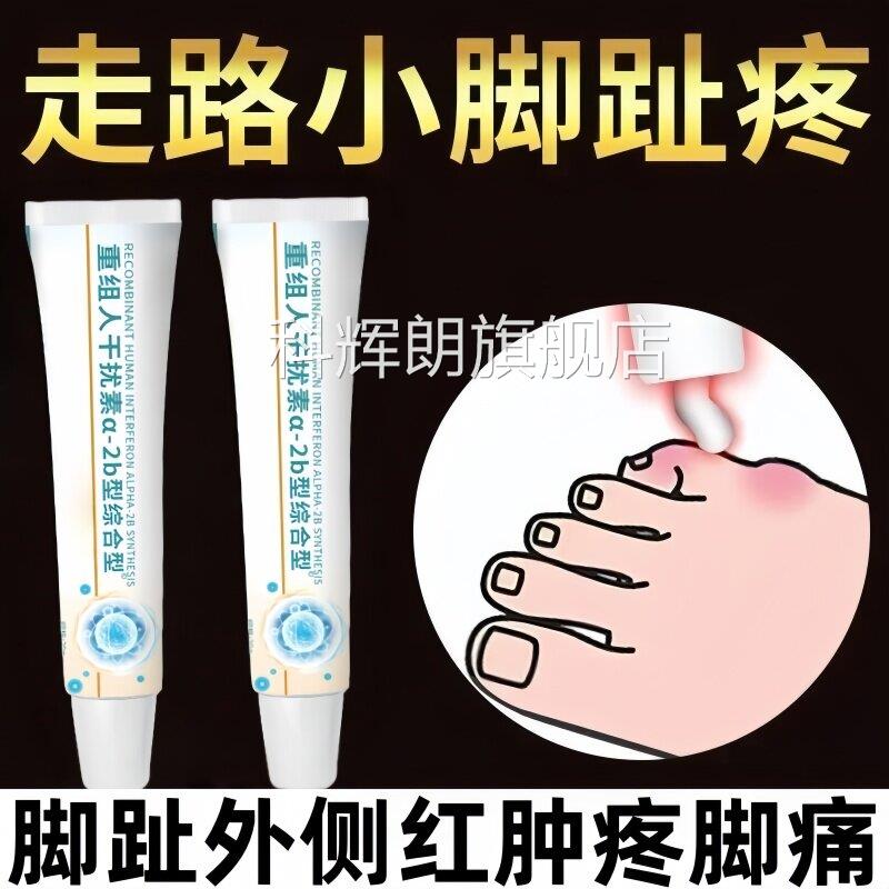 小脚趾头疼痛脚趾外侧疼红肿疼脚痛刺痛小脚趾头老茧穿鞋挤脚痛科