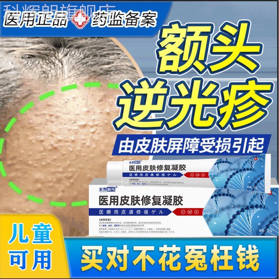 面部去逆光疹修复童脸上起小疙瘩闭口粉刺小颗粒屏儿障受损药膏TK