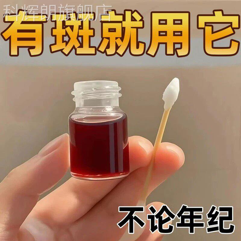 点志膏无痕药留水美容院正品脸部去祛黑点雀斑老年斑不疤美容金水