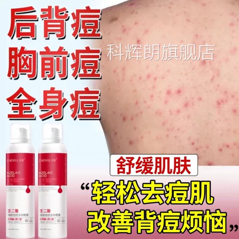 毛囊沐浴露膏药背上前胸背后特长痘痘去除后背部正除螨祛痘痒净品