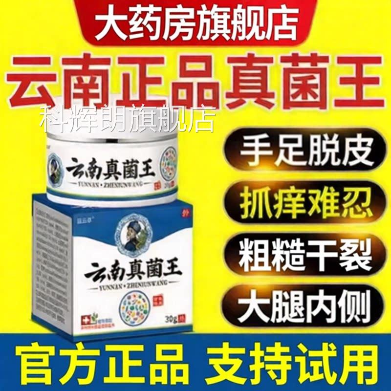 云南本草真菌王手脚脱皮臭脚丫痒水刨脚后跟起皮粗糙干裂抑菌膏科