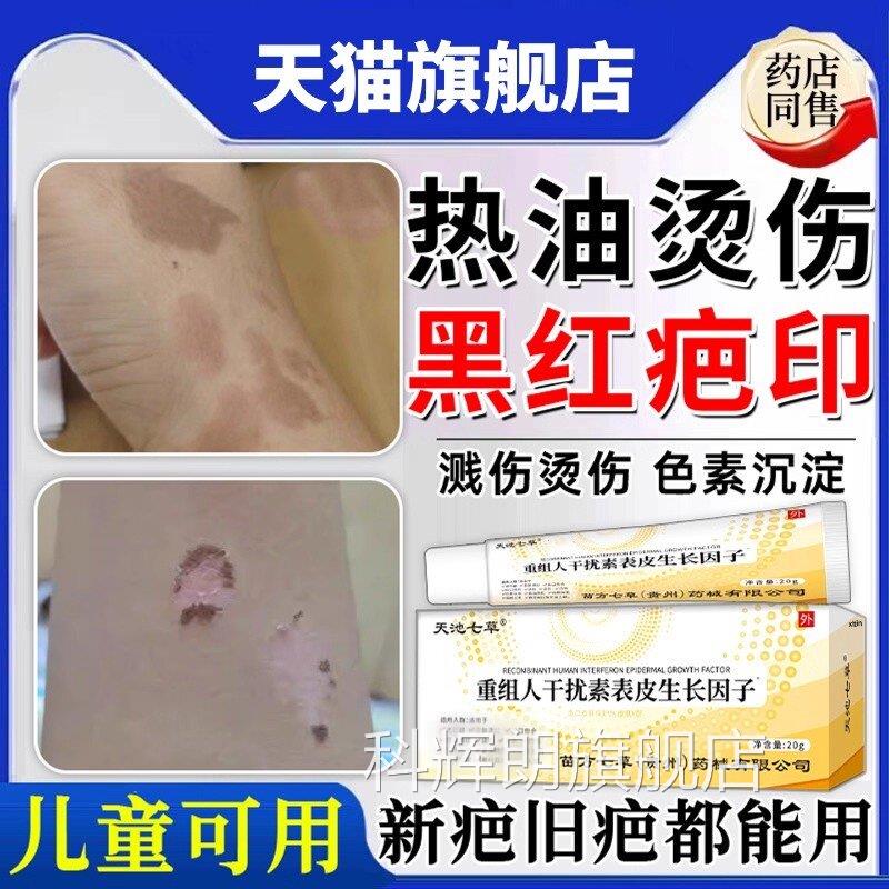 热油油烫伤烧伤去疤膏疤痕修复除疤膏儿童印祛去红黑印色素沉淀20