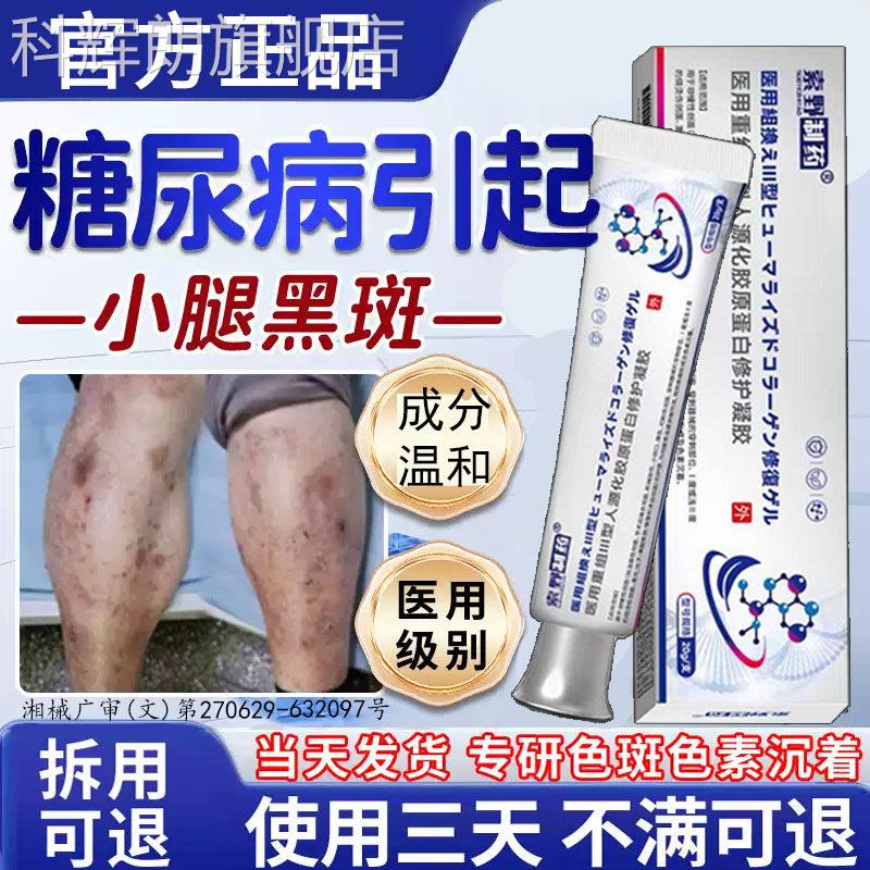 血糖高小腿斑胫前黑斑糖尿病疤痕印去除糖专用皮肤痒药房同售膏BD