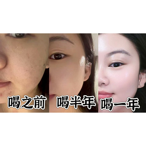 【张主任粉丝】三型真实反馈！！！