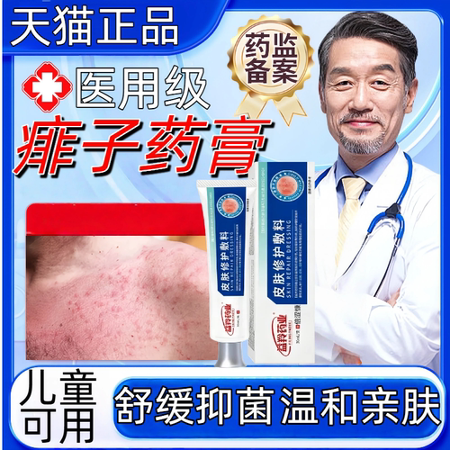 痱子药膏去痱止痒热毒湿爽疹身粉