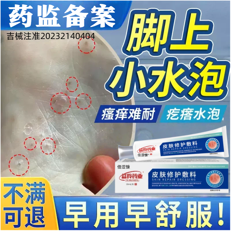 脚上汗泡疱疹去脚底起小水泡又痒又脱皮瘙痒根止痒膏药监备案lm