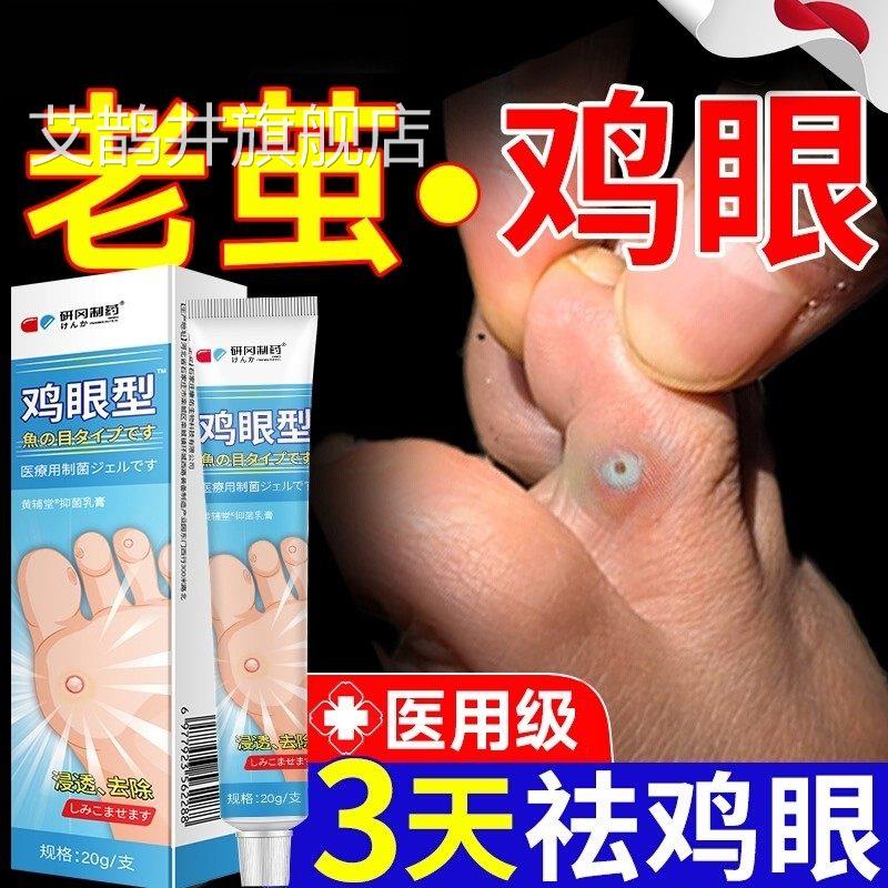 医用鸡眼膏鸡贴眼膏去除疣扁平疣跖疣老茧肉刺粒脚底足部药膏神器