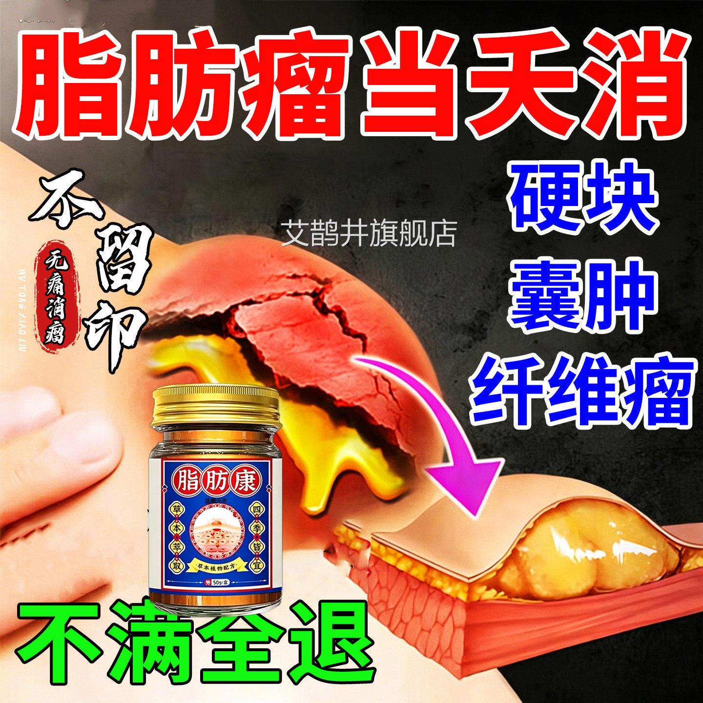 香港脂肪瘤消膏去除神瘤器皮下肿硬块特皮肤纤维脂腺囊肿效旗舰店