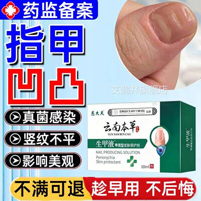 指甲凹凸不平修复液真菌感染甲面竖床纹受损不平养甲分离生长液WW