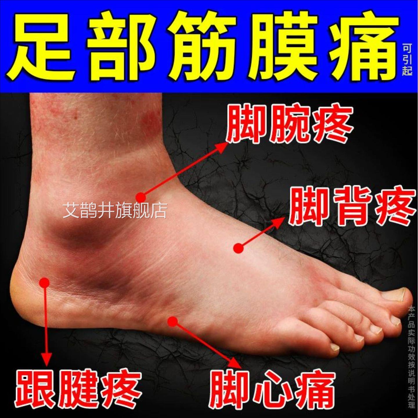 脚背踝筋膜炎疼痛脚面脚筋专用膏贴脚热敷贴腱鞘囊肿足背积液膏贴