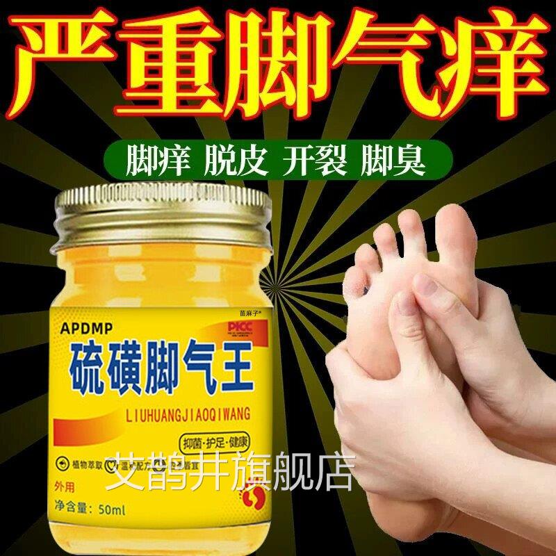 硫磺脚气王止痒泡脚真菌臭脚出汗去除真菌去脱皮烂脚丫抑菌软膏艾