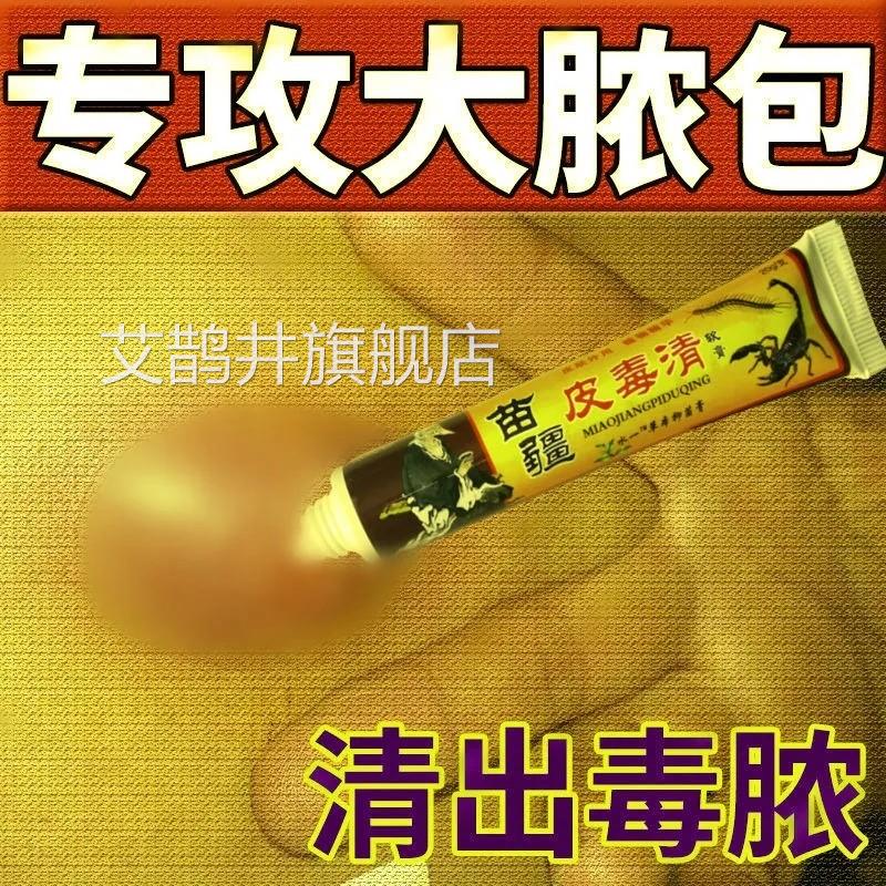 拔毒膏火疖子苗疆皮脂腺囊肿药膏拔脓膏痘痤疮去药膏屁股坐板疮神