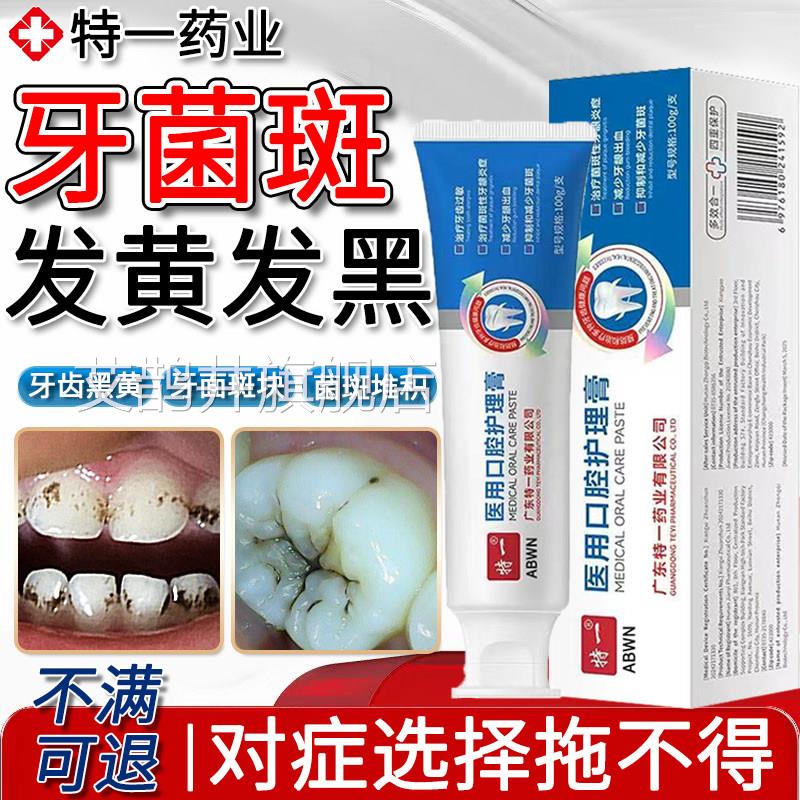 儿童牙菌斑去牙渍神器黑黄斑色素沉淀除牙窝黑线专抑菌祛牙斑用膏