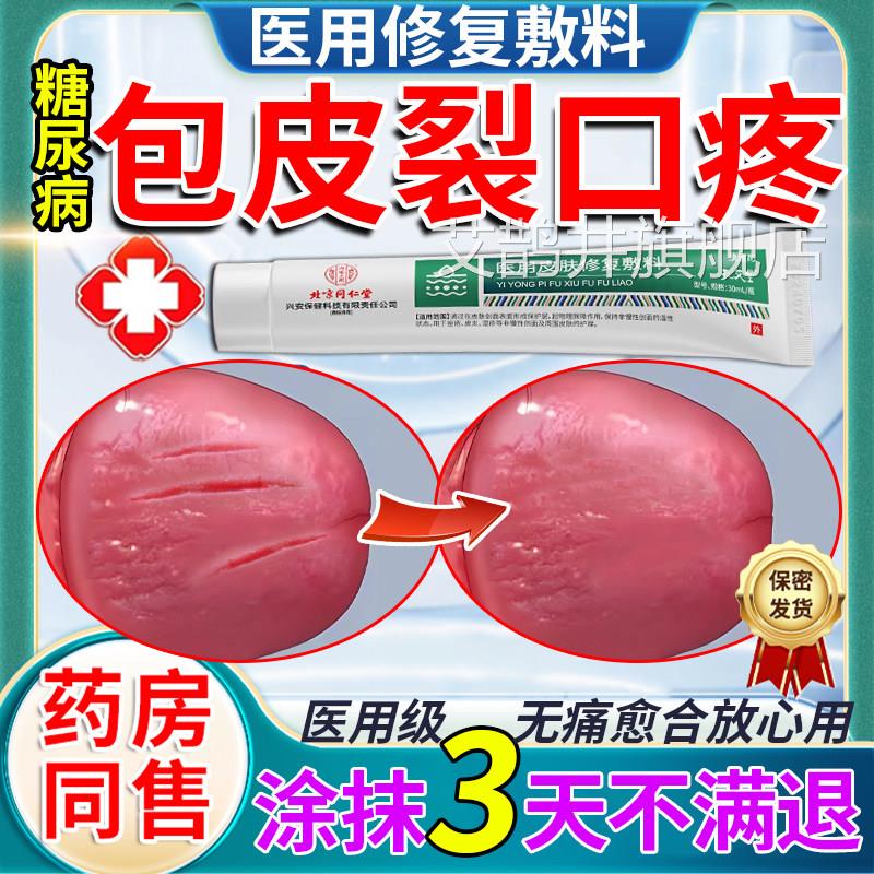 糖尿病包皮开裂发炎小裂口包皮炎龟头炎红肿瘙痒真菌感u染裂纹9艾