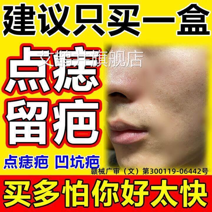 点痣后去疤痕修复膏增祛疤膏红印去黑印色素沉淀生点斑用修复液艾图片