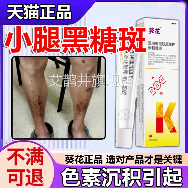 胫前糖斑糖尿病疤痕印小腿黑斑黑膏色素修复烂足伤口愈合祛腐p1艾