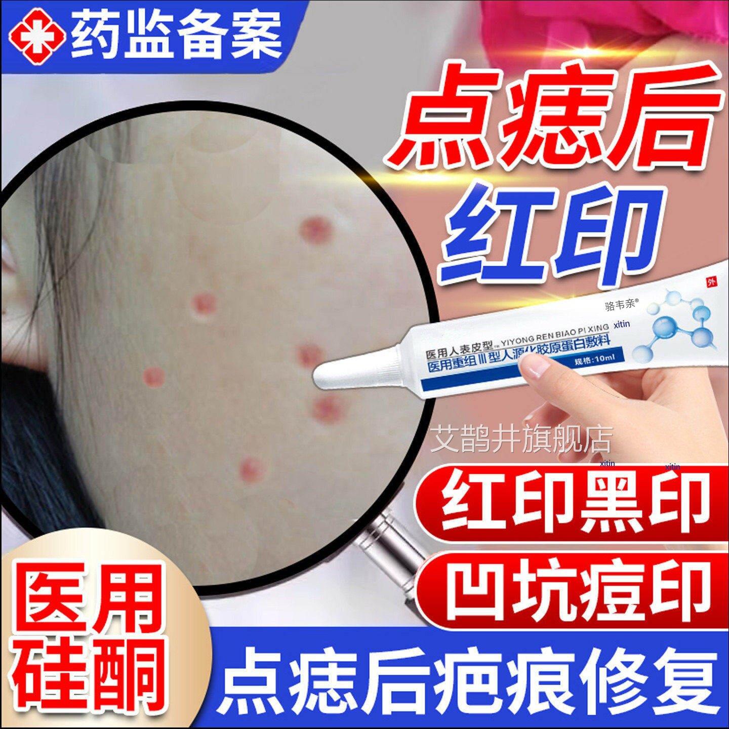 激光点斑祛痣点陷痣后去红印修复膏退红淡印液去痣凹疤痕专用TT艾