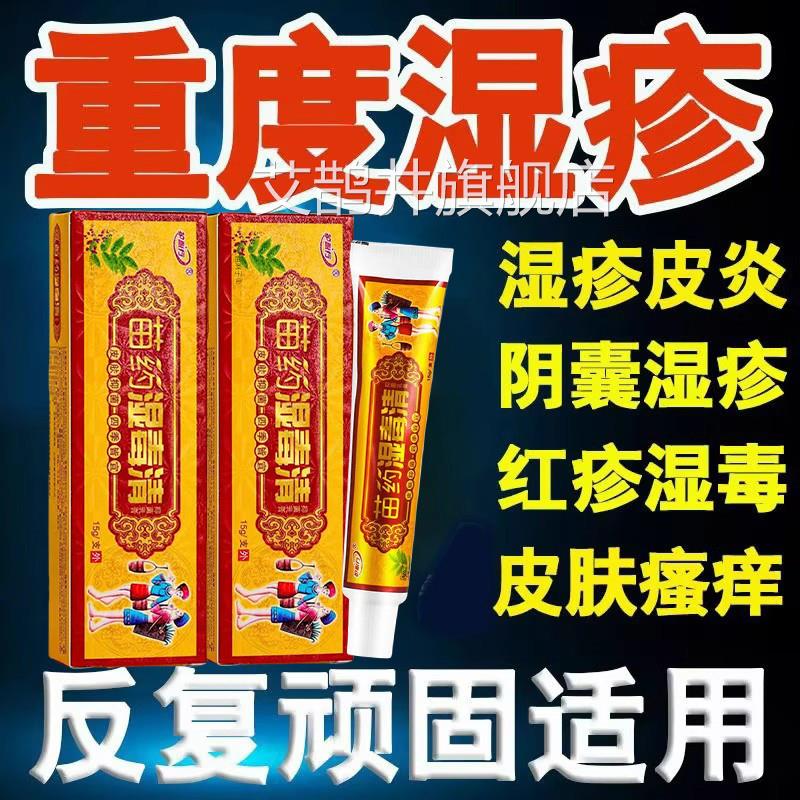 手癣膏脱皮干 干裂真菌感染手指湿疹毒止痒去药膏根水鹅掌风手上