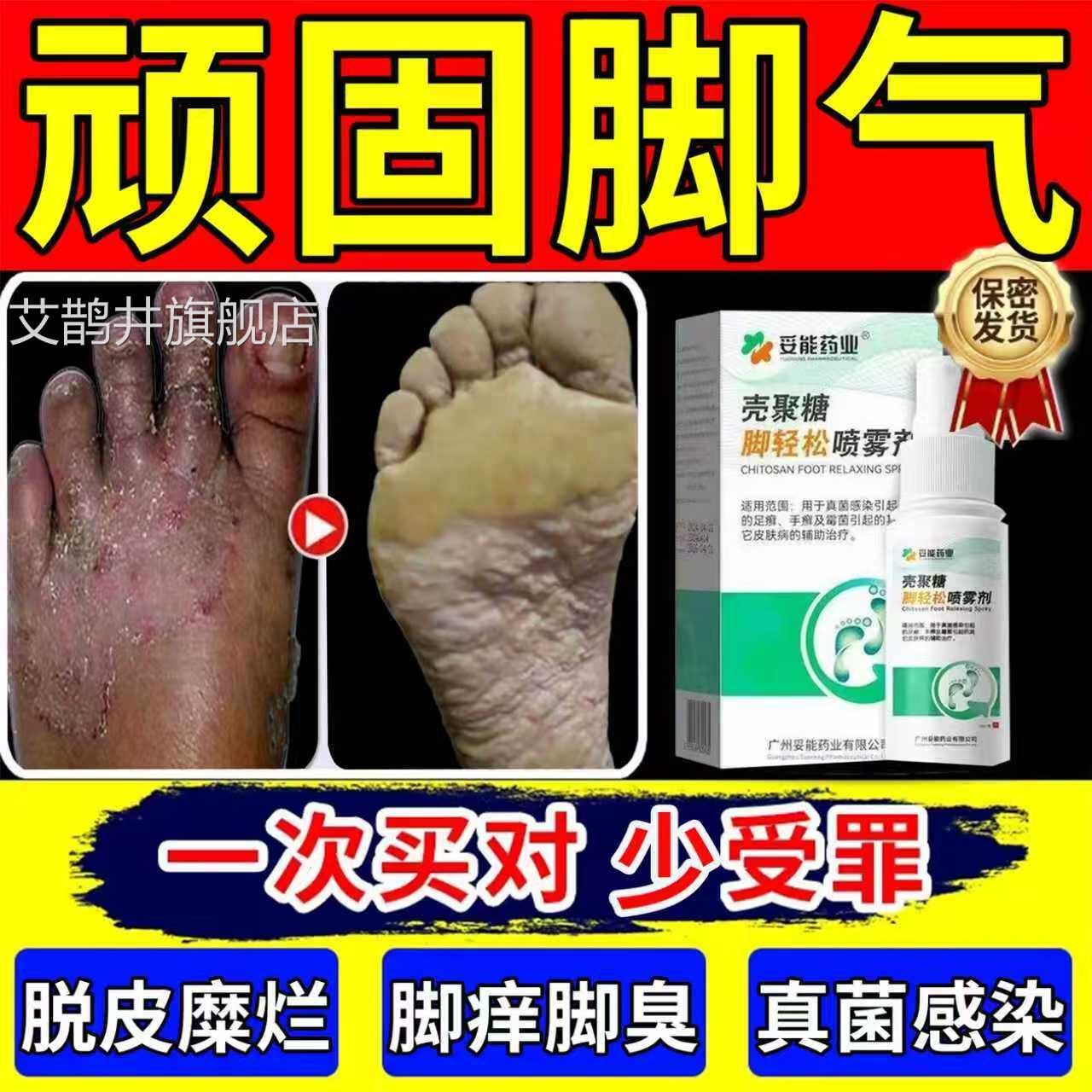 喷脚王治疗脚气脚止痒脱皮杀菌根去除专用特效膏狼毒官痒方旗舰店