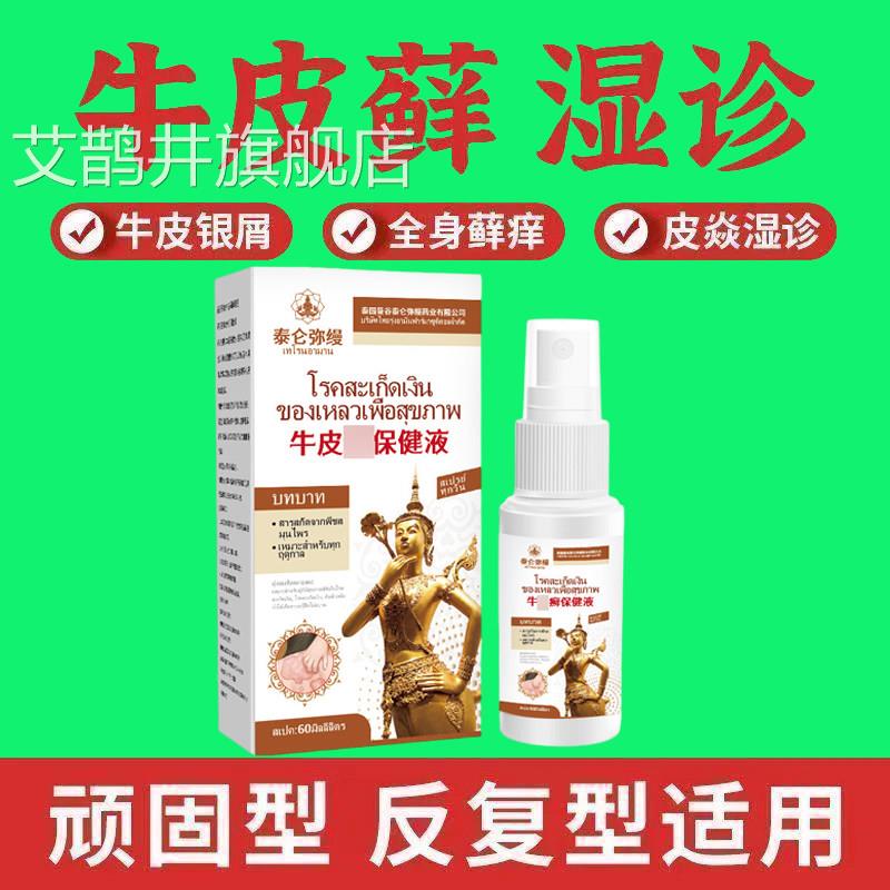 辅助治疗顽固牛皮癣银屑病专用大药房喷雾剂正品膏体股手癣湿疹非