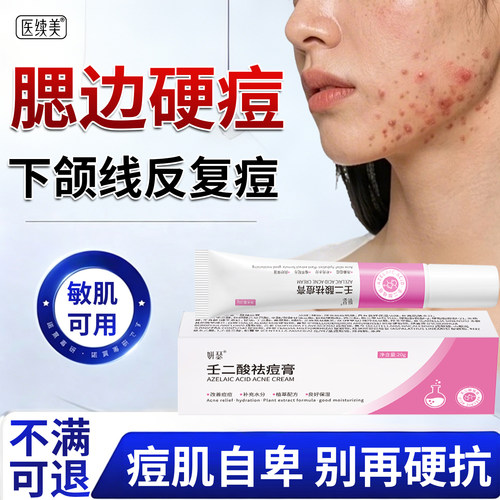 医续美淋巴痘腮边痘祛硬痘块脓包毛囊炎粉刺闭合痤疮下颌线脖子EF