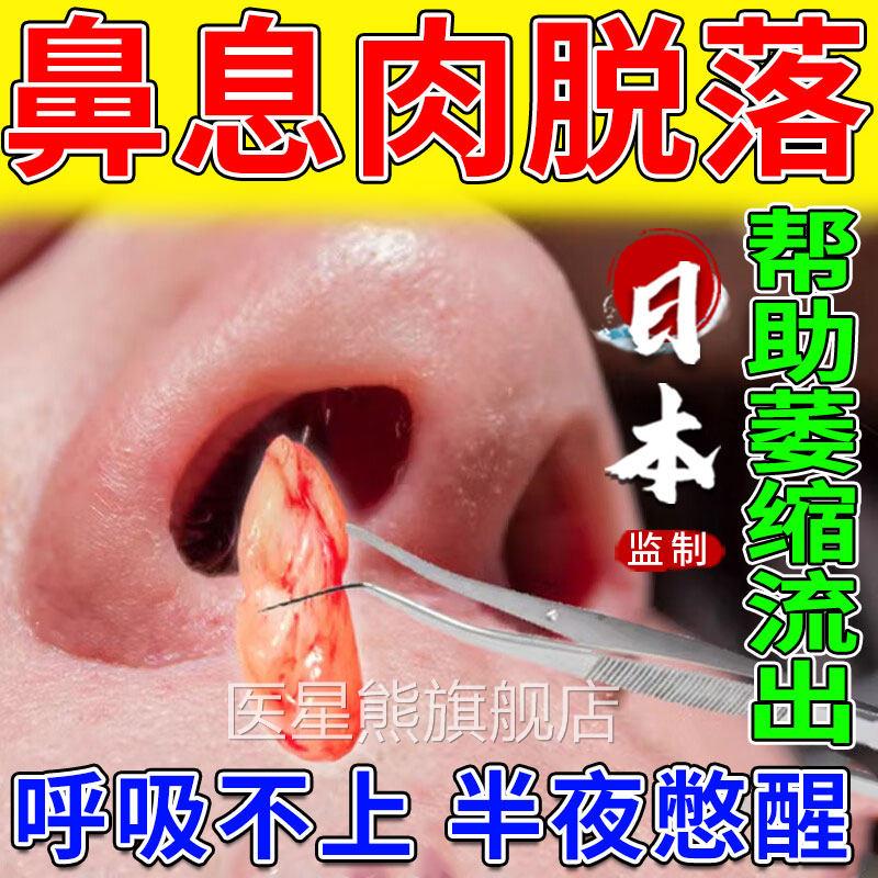 鼻息肉脱落专塞用喷雾剂可搭鼻窦炎修复鼻甲肥大鼻通鼻神器HB医星