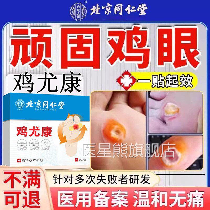 北京仁堂鸡眼膏同去医用级鸡尤康贴脚专用水杨酸顽固手部除医星熊
