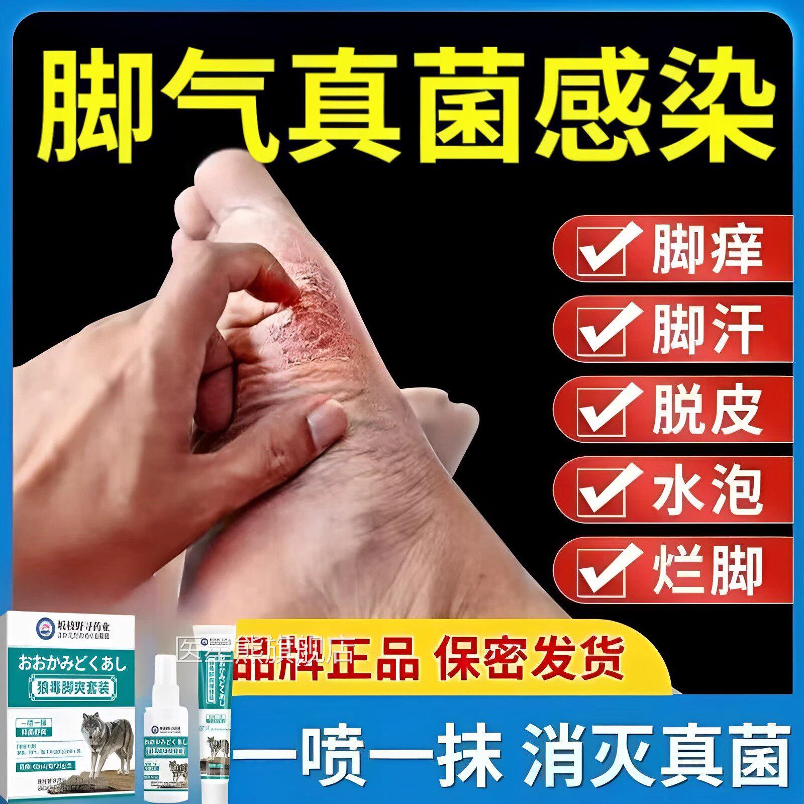 狼毒脚气喷剂喷雾臭烂脚丫脱皮糜烂脚趾缝乳烂痒脱皮杀菌止痒膏药