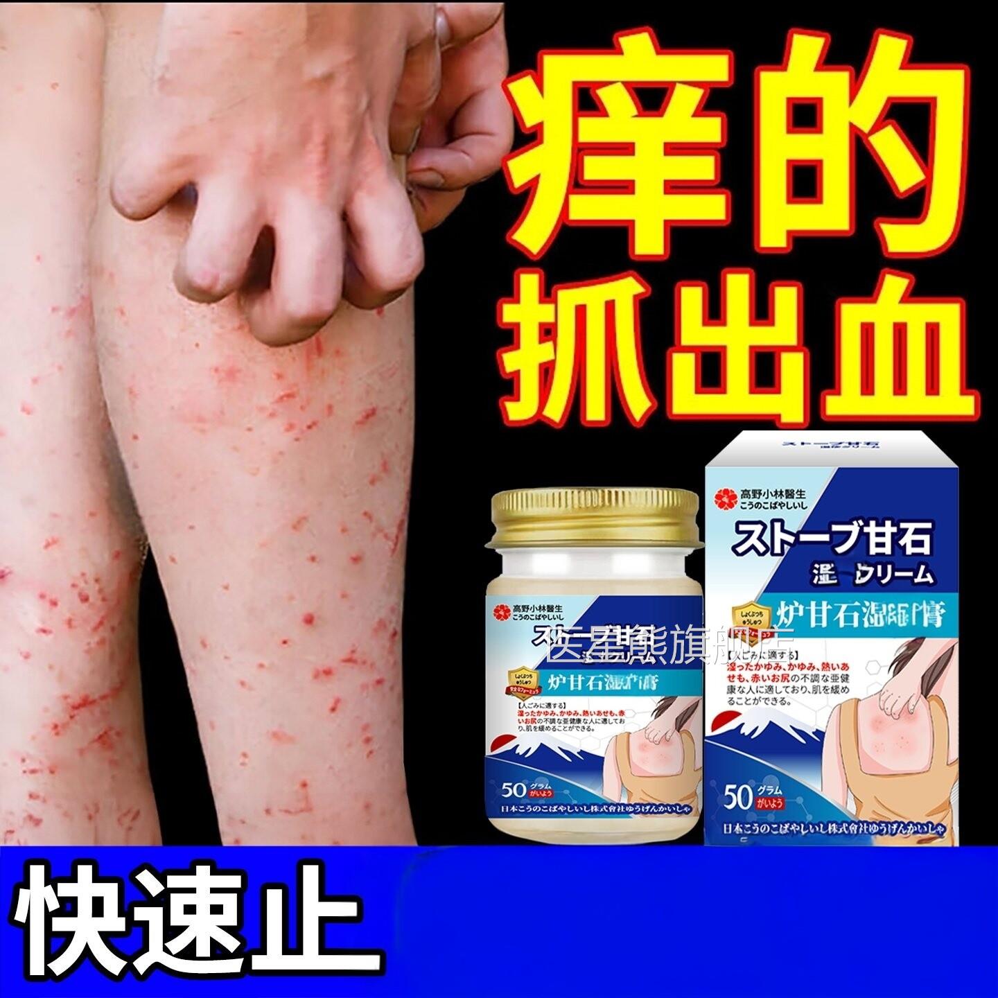 日本炉甘石湿疹去外用止顽固皮肤痒抑菌用除湿止膏医星熊旗舰店