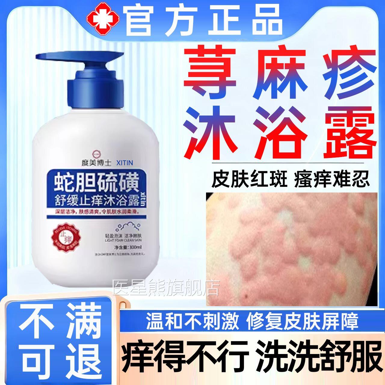 寻荨麻疹沐浴露专用香皂肥皂儿童断过敏止痒修皮肤中复药房同售UU