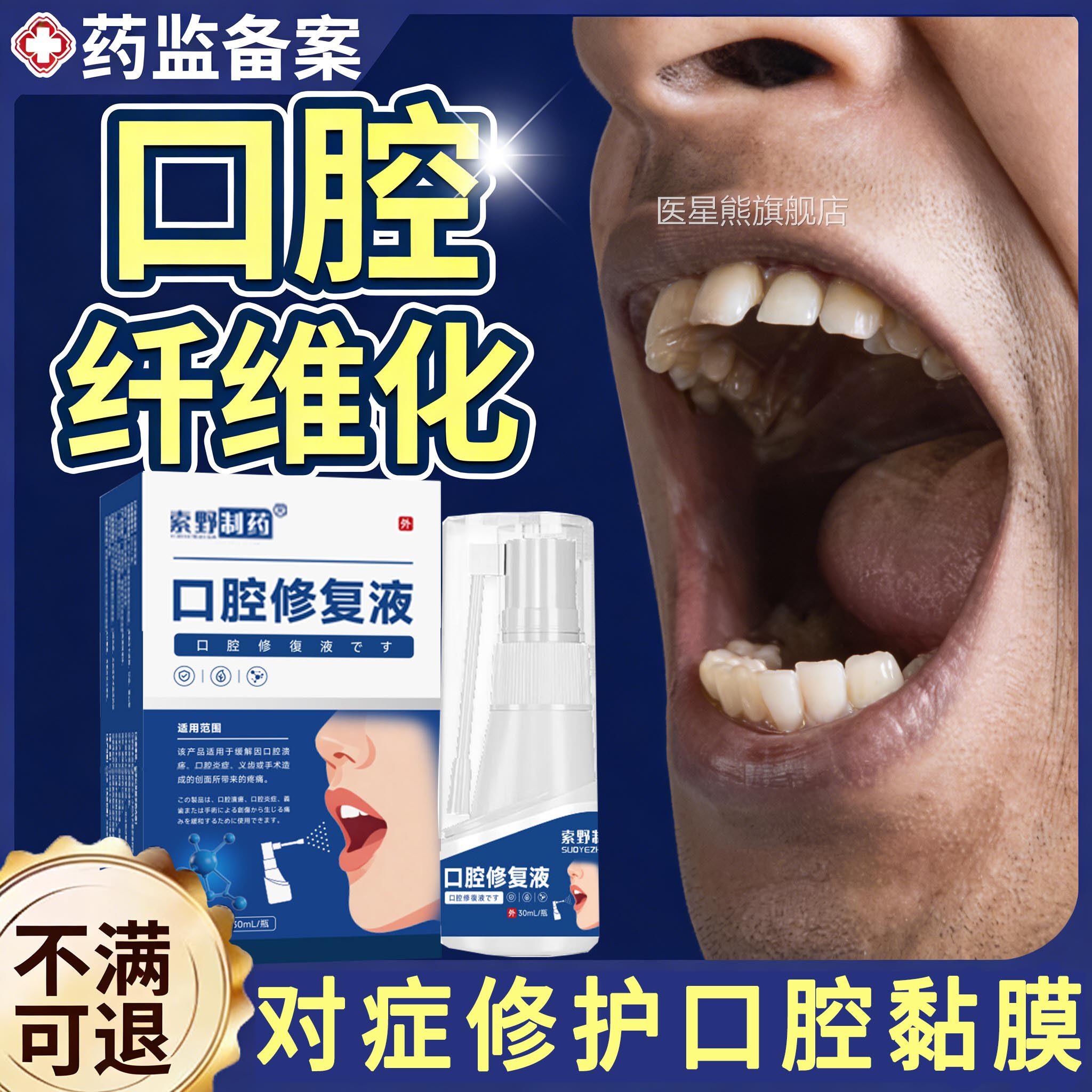 口腔膜纤维化修复液专用嚼槟榔白斑黏溃疡粘膜戒槟榔嘴药房同售Y7