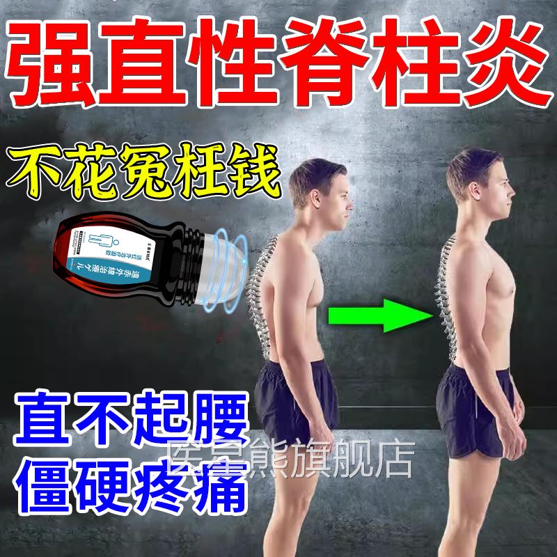 强直性脊柱炎H专用贴生物制剂强制性脊椎炎痛骶髂关节炎膏矫正器B
