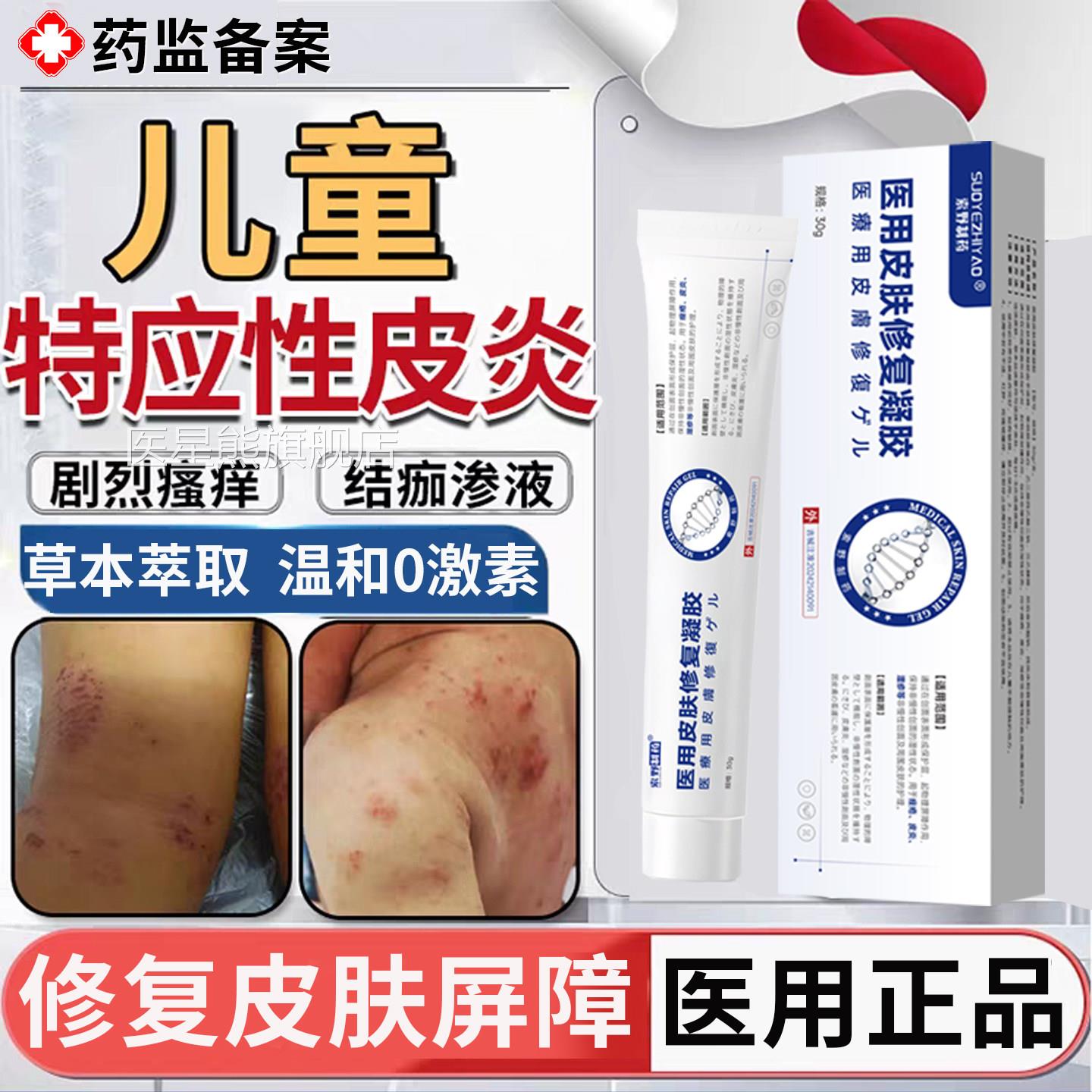 儿童特应性皮炎止痒保湿霜根身体乳软膏特异性宝宝干性去湿疹TK医