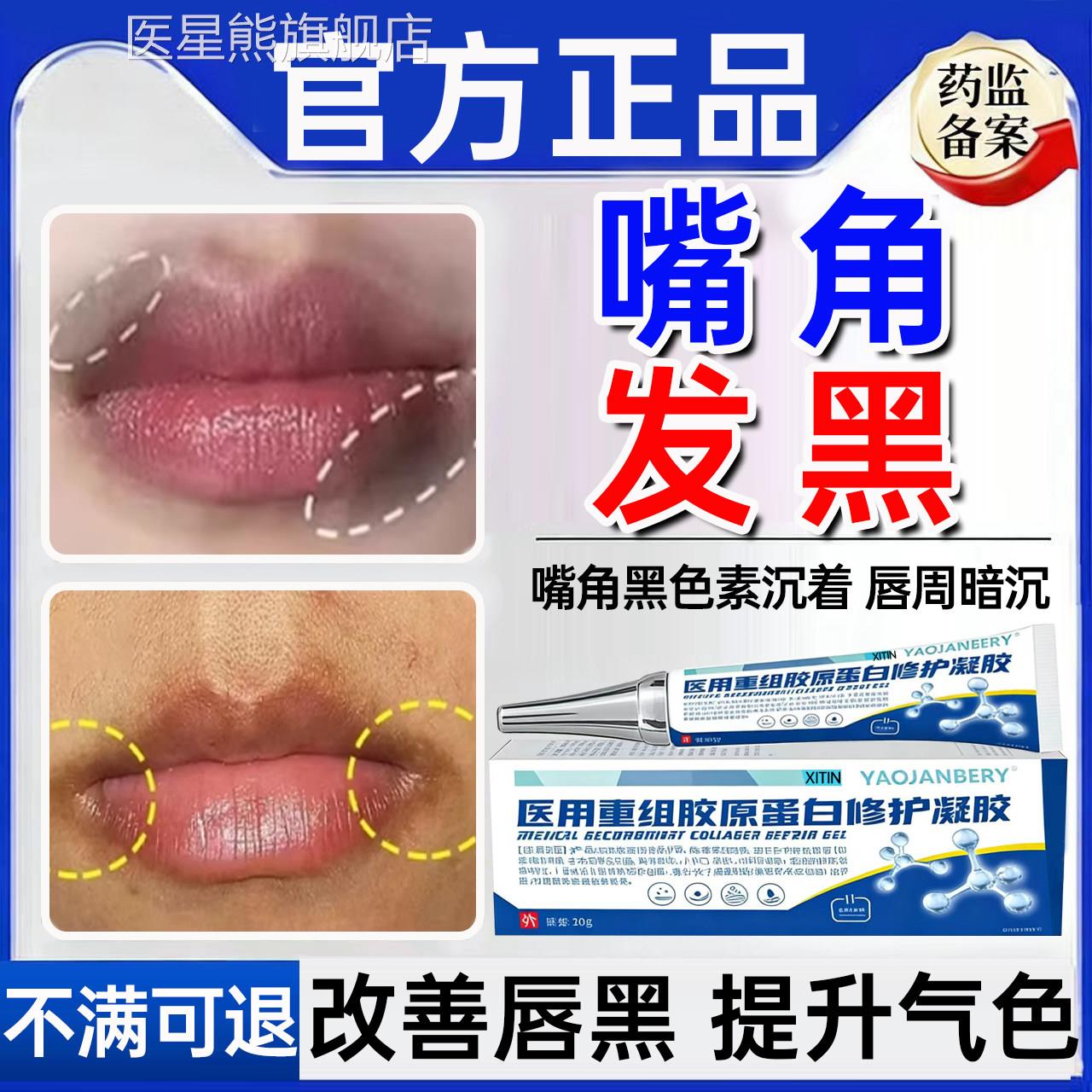 嘴角发黑去除嘴巴周边唇黑儿童可用改善炎唇周暗沉色素沉着凝胶UU