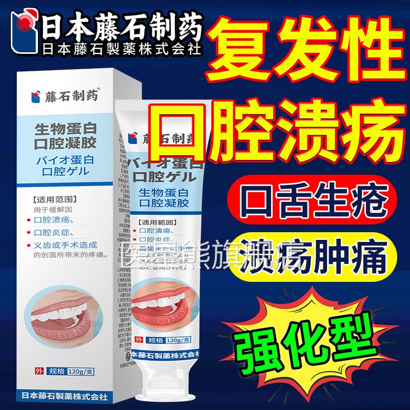 胶口腔溃疡专用可搭牙膏牙周炎清新口气克预防益生菌舒凝一点灵OM