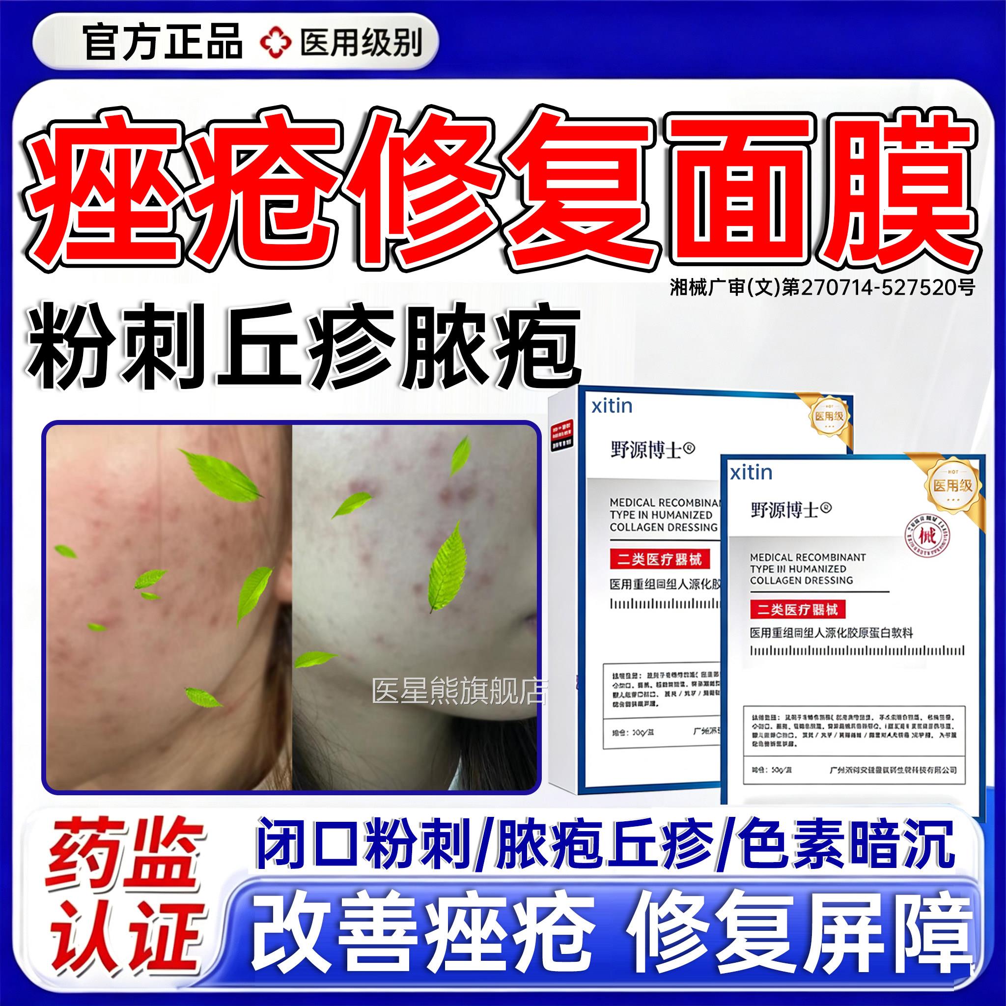 脸部痤疮医面膜用祛痘除玫瑰痤疮屏障痘修复痘消炎痘印毛囊炎PP医