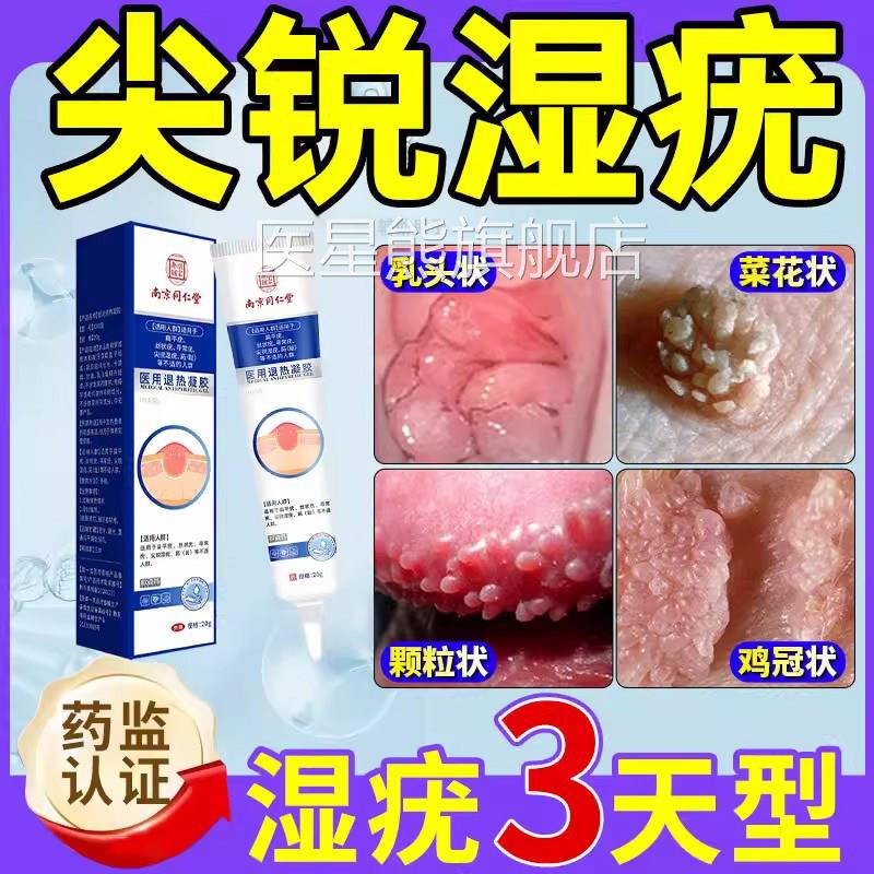 同仁堂疣清宁尖锐湿疹湿疣hpv疣药去膏男女性私处正品官方旗舰店