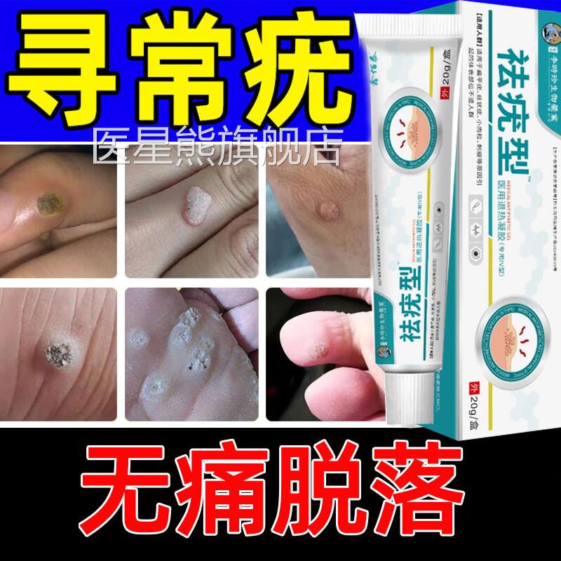 医李时珍扁平疣软膏用祛疣瘊小肉粒一抹灵无忧丝状正品官方旗舰店