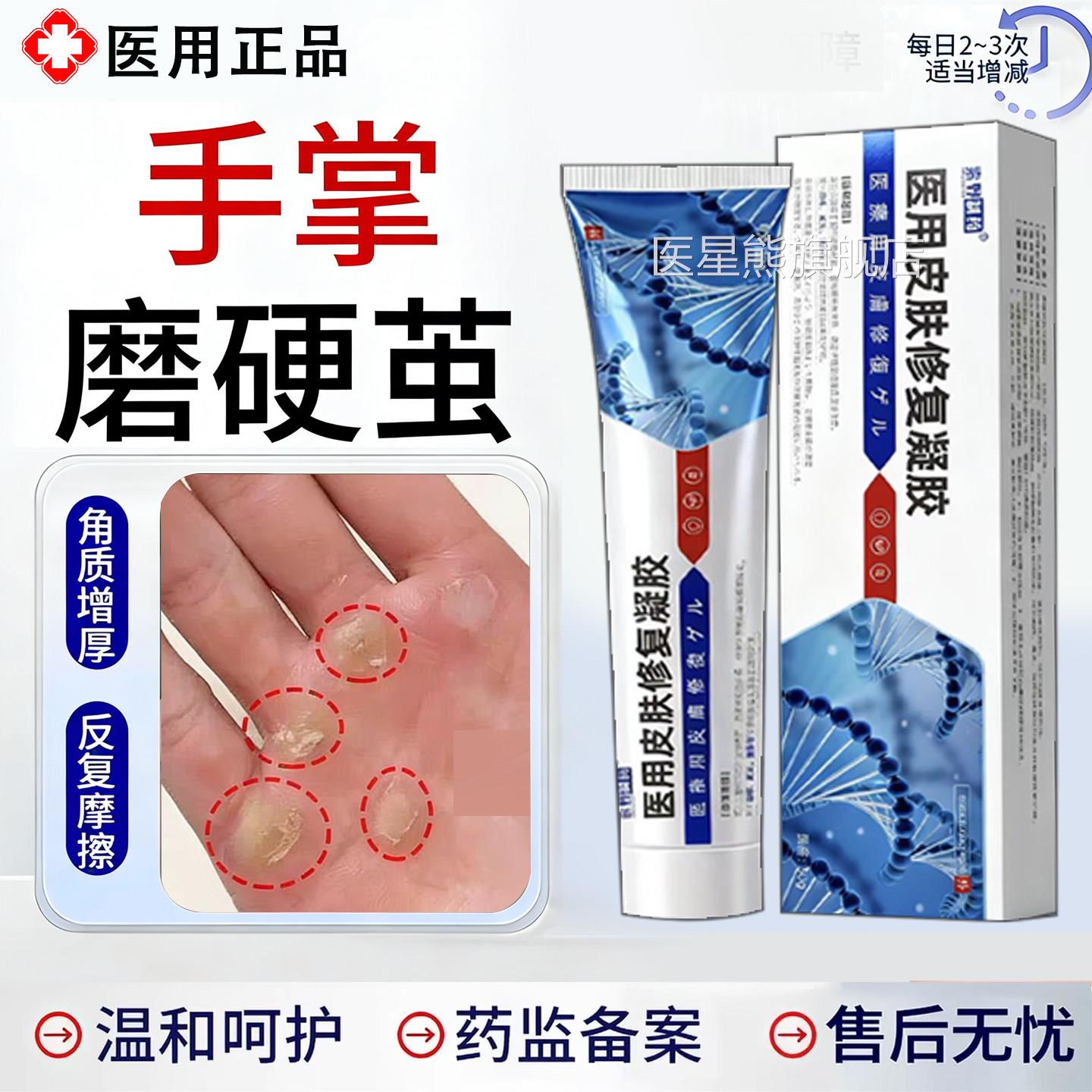 手茧手掌心长茧去手老茧死去除软化剂皮角质增厚硬疙瘩关节茧子TK