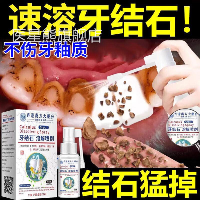 牙结石去除器医溶解用除漱水洗口牙齿污垢牙黄垢牙渍清理神器正品