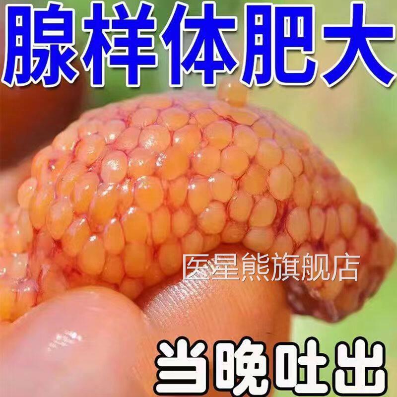 腺样体肥大中药贴儿童调理面容矫正扁桃体肿大器治鼻塞睡觉打呼噜