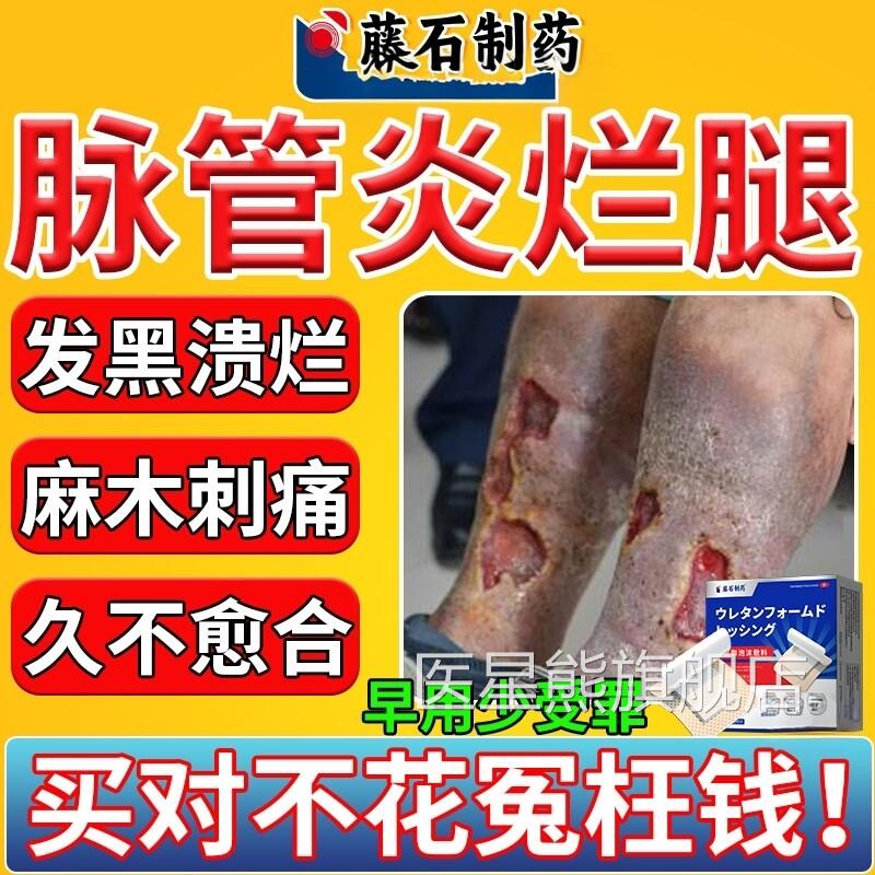 脉管炎老烂腿专用静脉曲张小腿血栓合烂足伤口愈药房同款膏CA医星